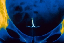 Spiral Karın Ağrısı Yapar mı? Spiral Karın Ağrısı Yapar mı?