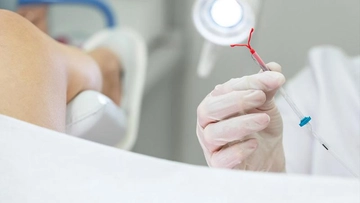 Spiral Kayması Ağrı Yapar mı? Spiral Kayması Ağrı Yapar mı?